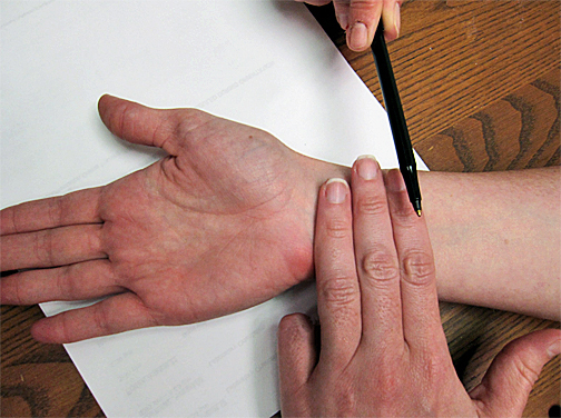 Locating P6 acupressure point for vertigo